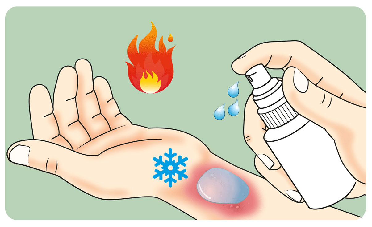 Burns The A to Z of rapid treatment Global